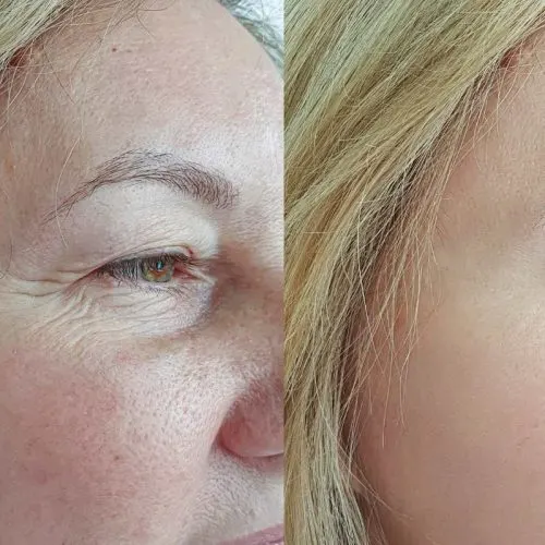Before and after treatment result