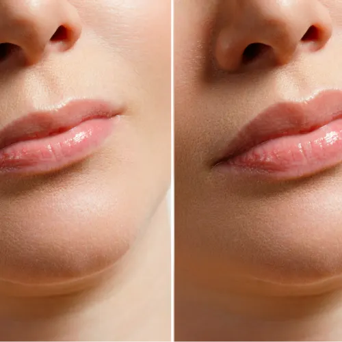Before and after treatment result