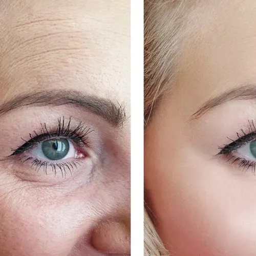Before and after treatment result