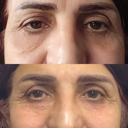Before and after treatment result